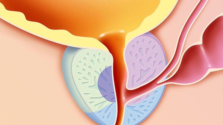 Prostat, mesane çıkışında bulunan 18-20 gramlık bir bezdir ve asıl