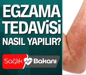 Egzama Nedir Nasıl Oluşur? Cilt hastalıkları, dış çevre ile gözle