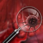 Turkiye-kanser-vakfi-nedir