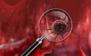 Türkiye Kanser Vakfı Nedir? Çalışmaları ve Topluma Katkıları Kanser, günümüzde dünya genelinde olduğu gibi Türkiye’de de en önemli